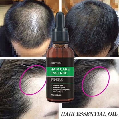 Premium Hair Growth Essential Oil – Nourishing, Strengthening & OEM Custom Formula