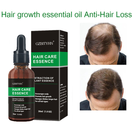 Premium Hair Growth Essential Oil – Nourishing, Strengthening & OEM Custom Formula