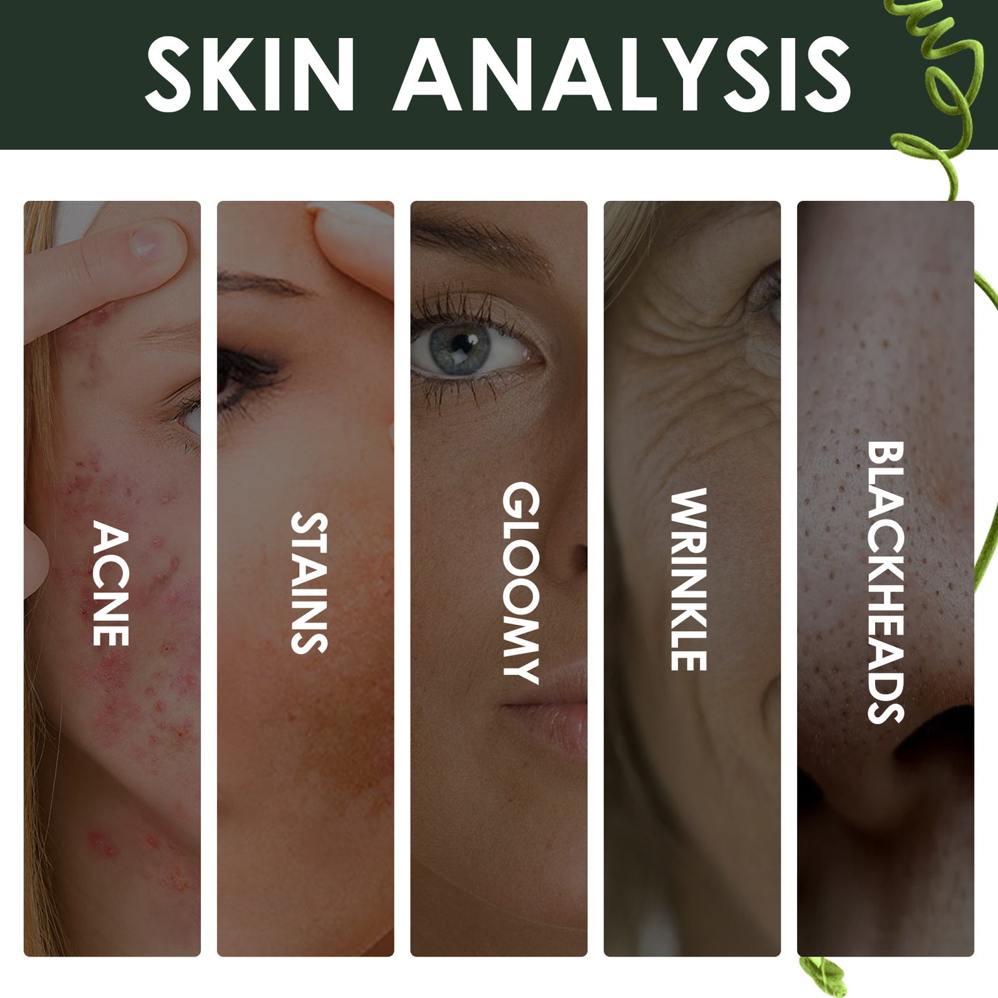 Acne Marks Blackhead Brightening Skin